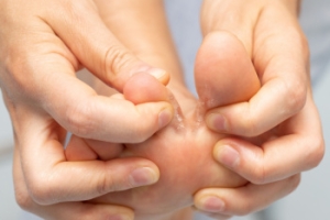 Itching and Burning Feet