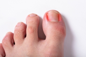 Understanding Curved Nails