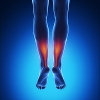 Achilles Tendonitis Can Turn Into Tendonosis