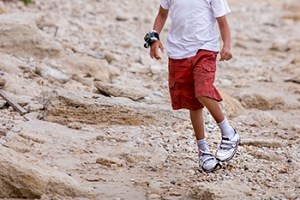 Clubfoot Is a Congenital Foot Deformity