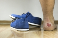 A Medical Condition May Cause Blisters on the Feet